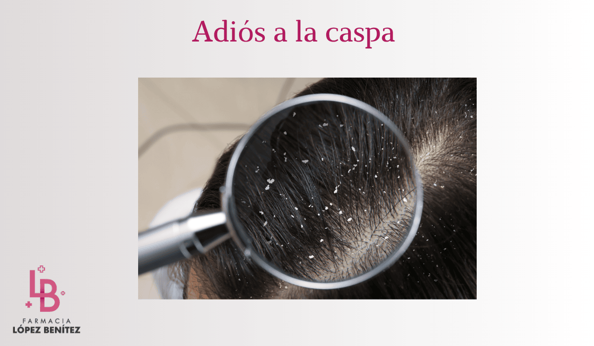 Te Ayudaré a Despedirte de la Caspa para Siempre